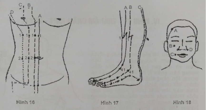 Hình vẽ 16, 17, 18