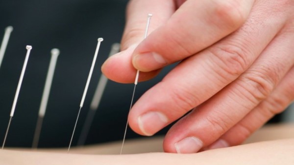 Cham cuu trị bệnh