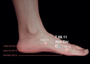 Huyệt Hỏa cúc- Đổng thị kỳ huyệt