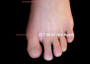 Huyệt Hỏa nghạch- Đổng thị kỳ huyệt