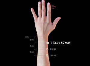 Huyệt Kỳ môn - châm cứu Đổng thị