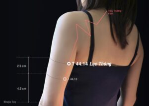 Huyệt Lạc thông - châm cứu Đổng thị