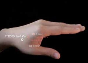 Huyệt Linh cốt- Đổng thị kỳ huyệt