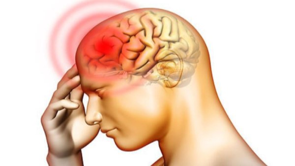 Lưu lượng máu não