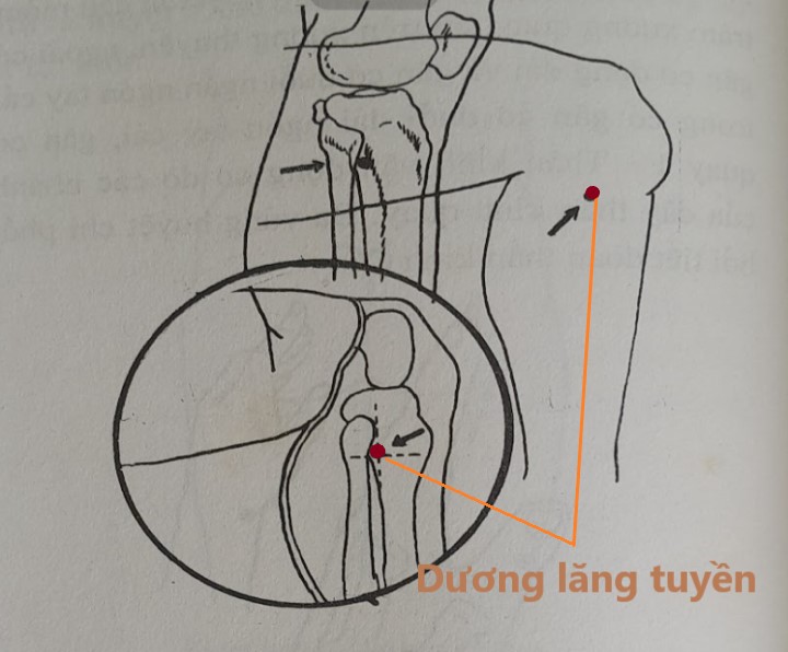 Vị trí huyệt Dương Lăng Tuyền