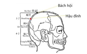 huyệt Hậu đỉnh