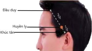 huyệt Huyền ly