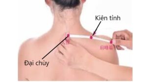 huyệt Kiên tỉnh