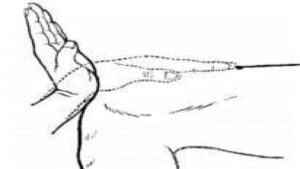 huyệt phục thỏ