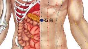 huyệt Thạch quan