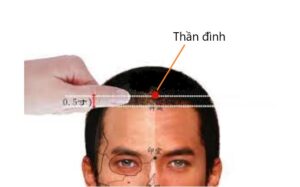 huyệt Thần đình