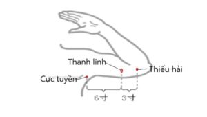 huyệt thanh linh
