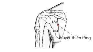 huyệt thiên tông