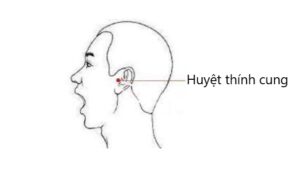 huyệt thính cung