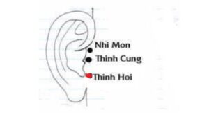 huyệt Thính hội