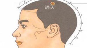 huyệt Thông thiên