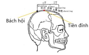 huyệt tiền đỉnh