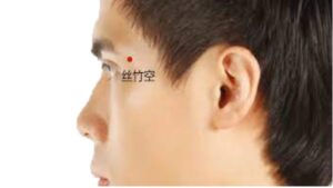 huyệt Ty trúc không