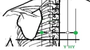 Vị trí huyệt Y hy