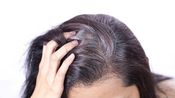 Râu tóc bạc sớm